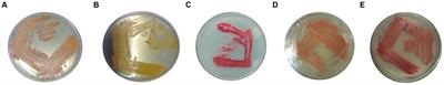 Bioprospecting of serratiopeptidase-producing bacteria from different sources